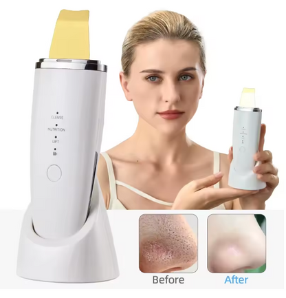 Ultrasonic Blackhead Remover